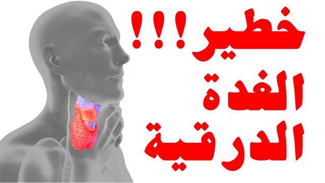 مراكز العلاج باليود المشع في مصر: VuDoctor اختيارك الافضل